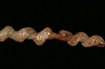 Hoe giftig zijn we eigenlijk?