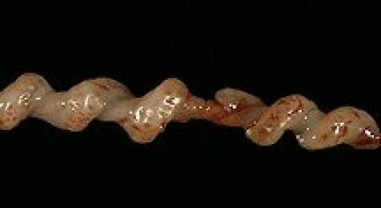 Hoe giftig zijn we eigenlijk?