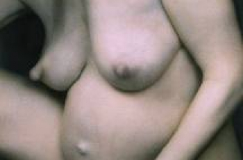 Wat kun je doen tegen zwangerschapskwaaltjes?