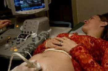 Gezond zwanger worden