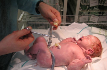 Wat doen we met de navelstreng?