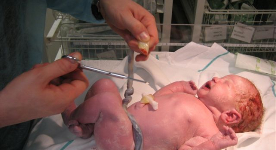 Wat doen we met de navelstreng?