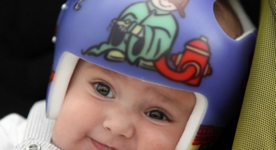 Helmpje helpt echt niet