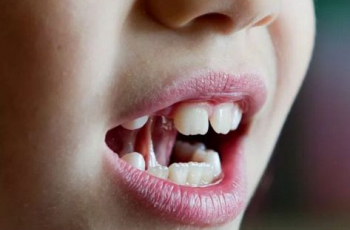 Kindertaal | Gratis taal- en spraakadviezen