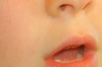 Stotteren - tips voor ouders