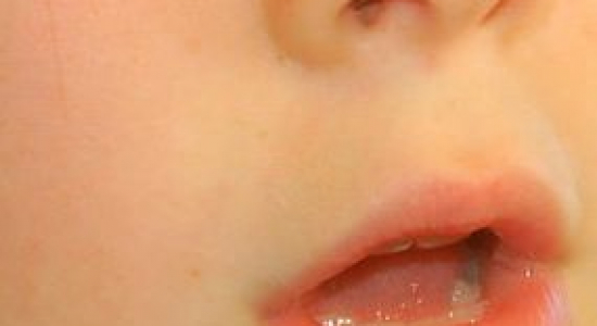 Stotteren - tips voor ouders