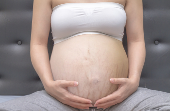6 tips om striae tijdens je zwangerschap te voorkomen