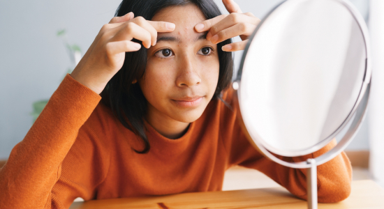 Heeft je kind last van acne? Dit stappenplan maakt korte metten met puistjes