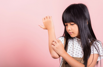 Heeft je kind netelroos of is het iets anders? Zo herken je netelroos én zorg je dat het weer verdwijnt