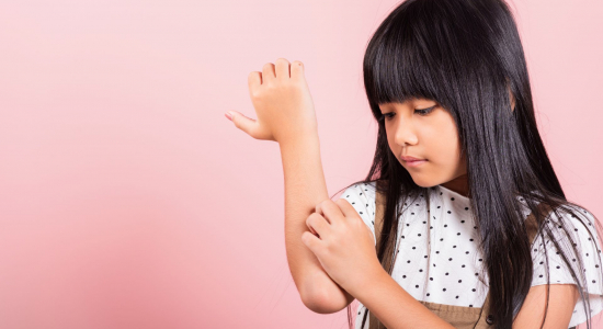 Heeft je kind netelroos of is het iets anders? Zo herken je netelroos én zorg je dat het weer verdwijnt