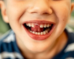 Is je kind rond de 8 jaar en nog geen melktand kwijt? Dit wil je weten over tanden wisselen